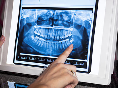 Meadowbrook Dental | Veneers, Pediatric Dentistry and Dental Bridges