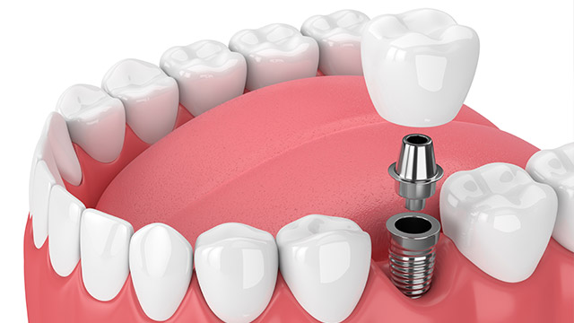 Dentist in Auburn Hills