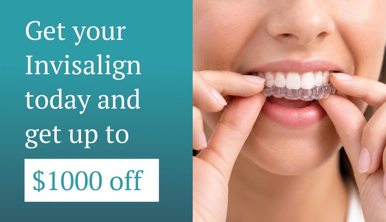 Get your Invisalign today and get up to $1,000 off.